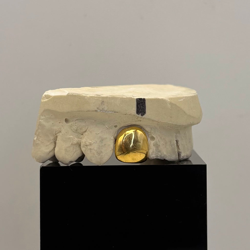 Single Cap Grillz