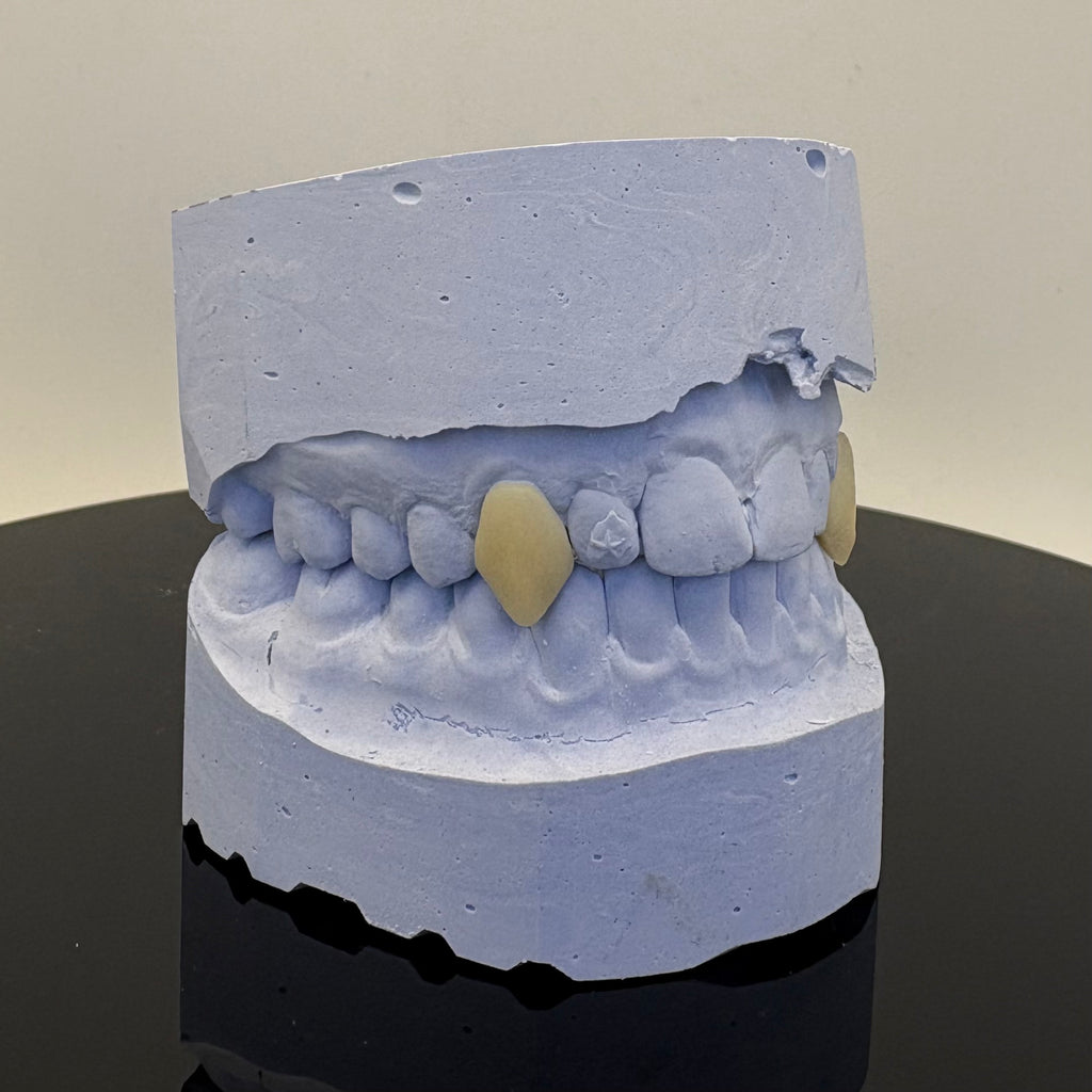 Vampire Fangs Set