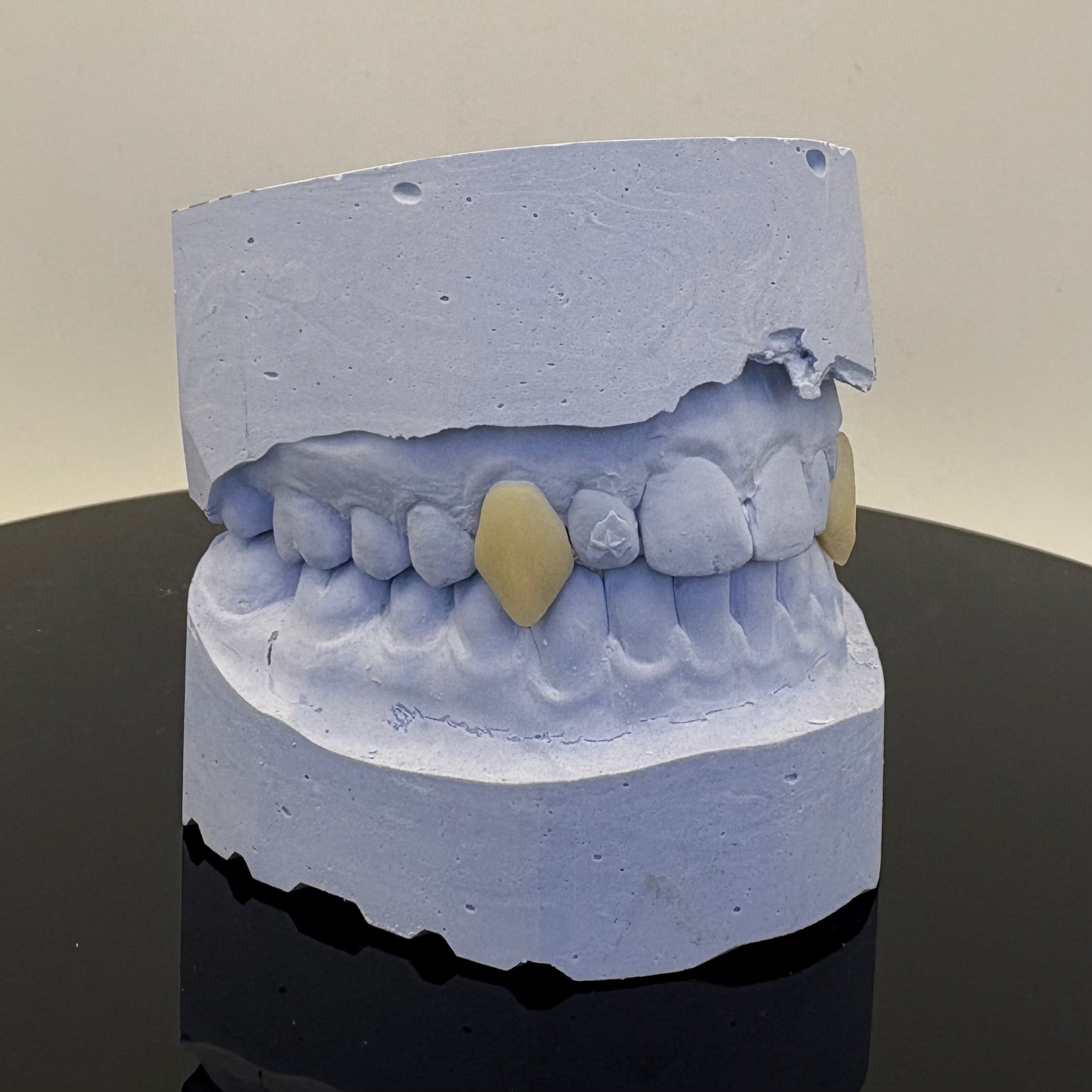 Vampire Fangs Set